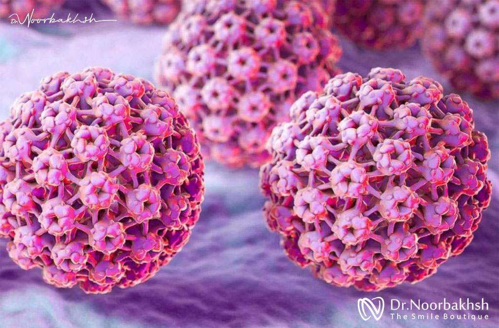زگیل تناسلی HPV دهانی چیست و چه ارتباطی با دندانپزشکی دارد؟