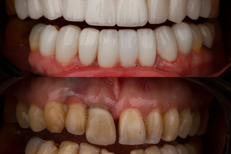 reconstruction (2)